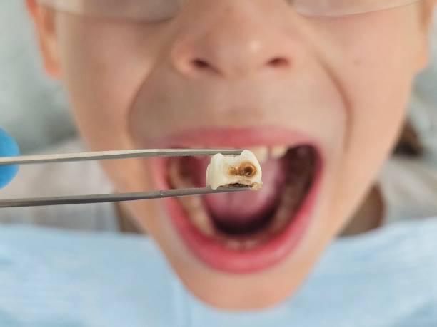 Best Emergency Orthodontic Repairs in Brookston, IN